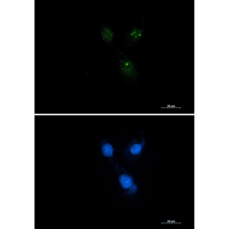 Presenilin 1 Rabbit Monoclonal Antibody