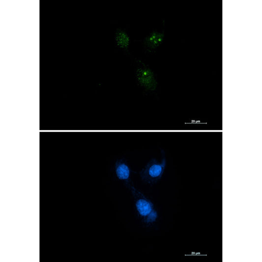 Presenilin 1 Rabbit Monoclonal Antibody