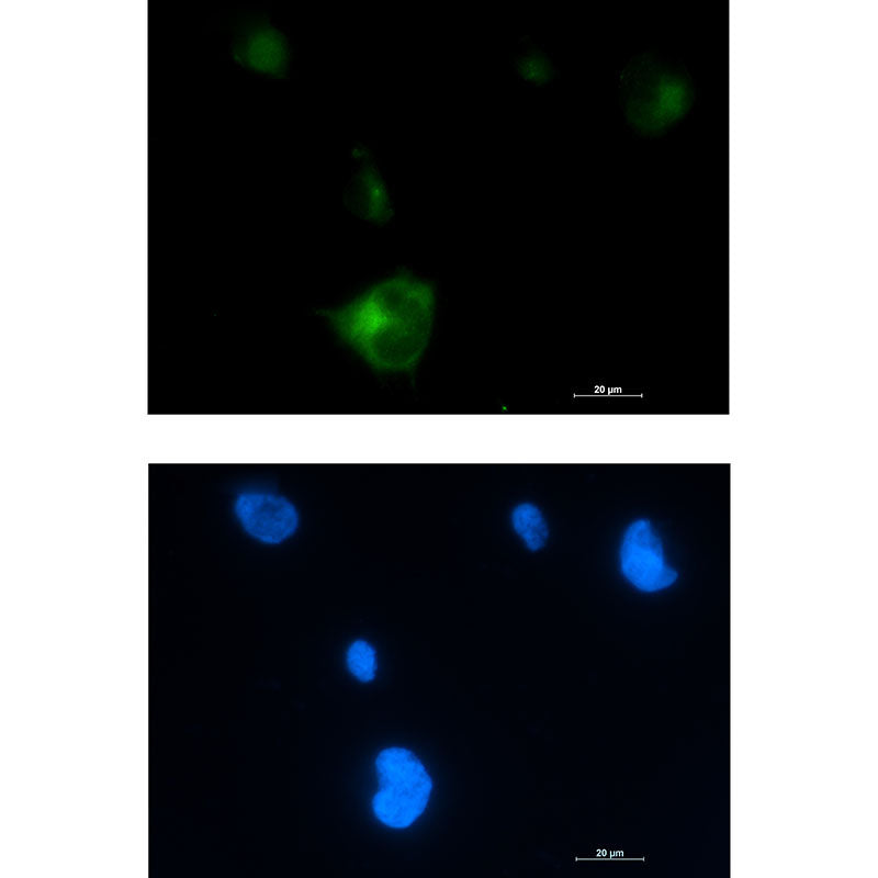 Rab5 Rabbit Monoclonal Antibody