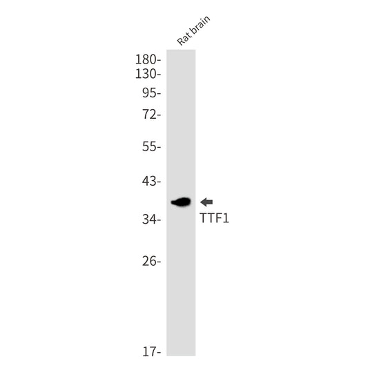 Thyroid Transcription Factor 1 Rabbit Monoclonal Antibody