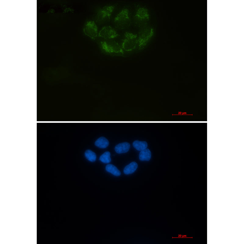 CD147 Rabbit Monoclonal Antibody