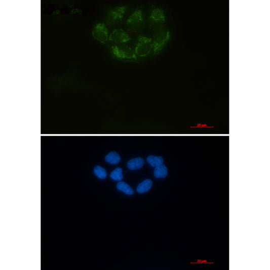 CD147 Rabbit Monoclonal Antibody