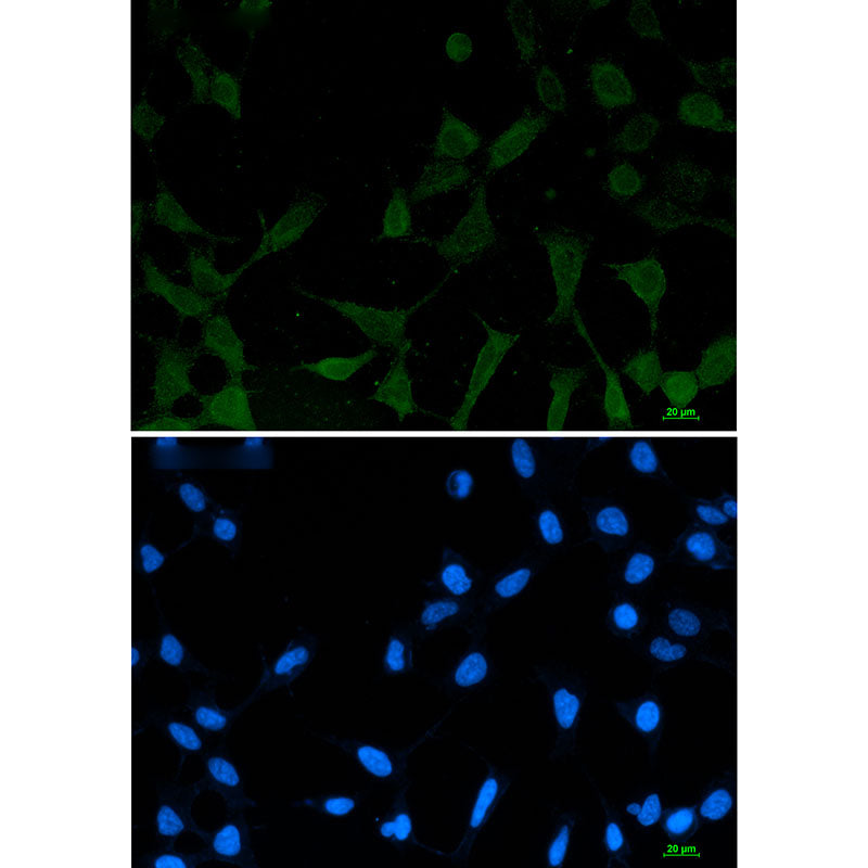 Phospho-NDRG1 (Ser330) Rabbit Monoclonal Antibody