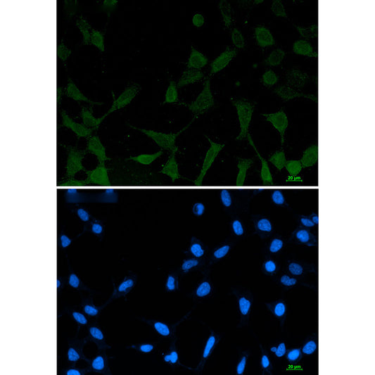 Phospho-NDRG1 (Ser330) Rabbit Monoclonal Antibody