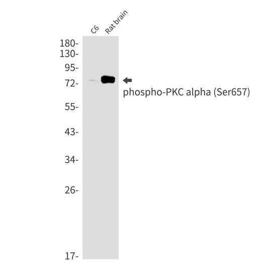 Phospho-PKC alpha (Ser657) Rabbit Monoclonal Antibody