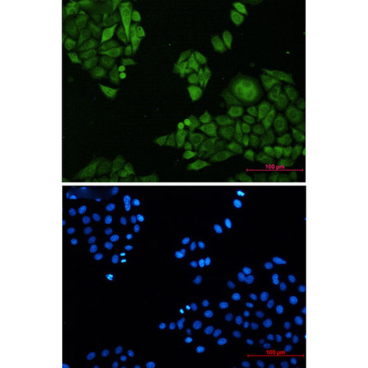Annexin 4 Rabbit Monoclonal Antibody