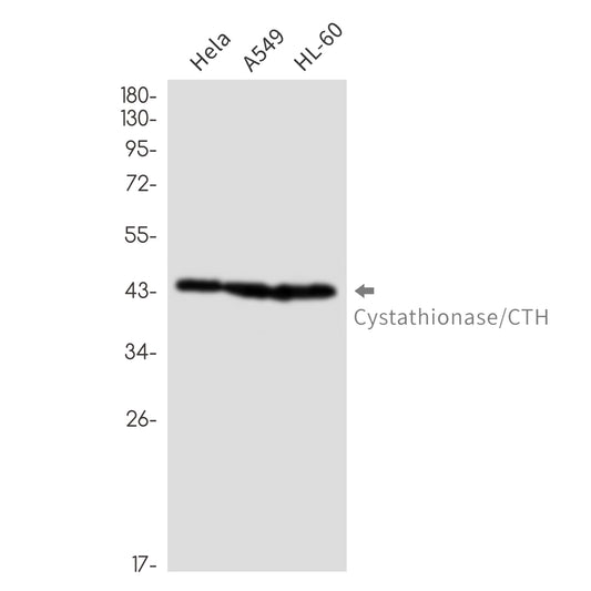 Cystathionase Rabbit Monoclonal Antibody