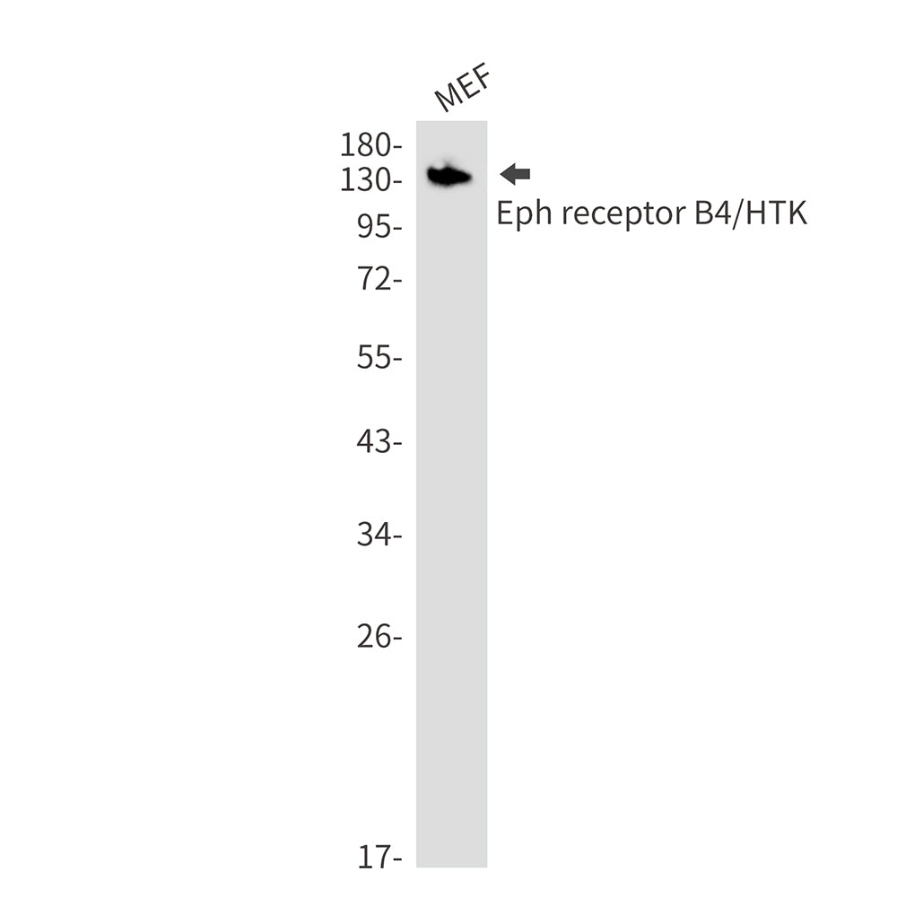 Ephrin Receptor B4 Rabbit Monoclonal Antibody