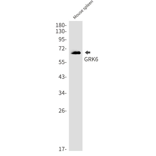 GRK6 Rabbit Monoclonal Antibody