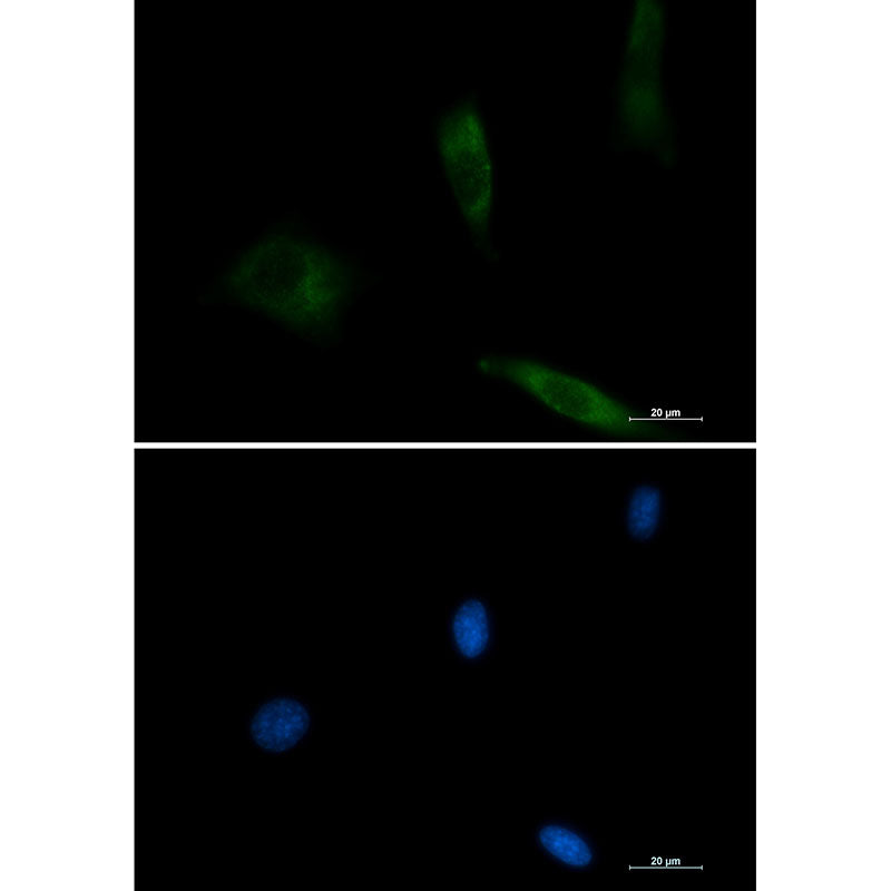 EGFR Rabbit Monoclonal Antibody