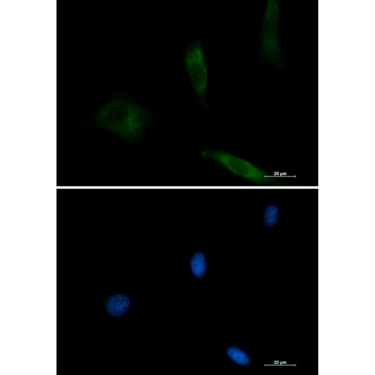 EGFR Rabbit Monoclonal Antibody
