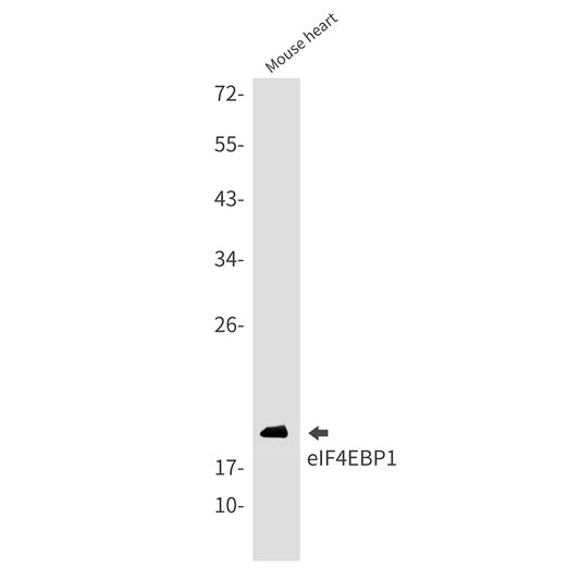 4E BP1 Rabbit Monoclonal Antibody
