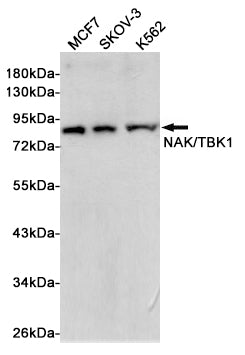 TBK1 Rabbit Monoclonal Antibody