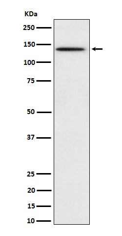 Phospho-BCAR1 (Y410) (17X7) Rabbit Monoclonal Antibody