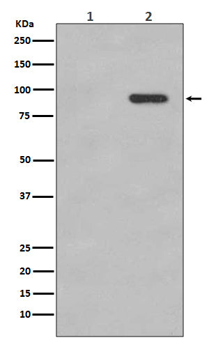 Phospho-beta Catenin (S33/S37) (7V18) Rabbit Monoclonal Antibody