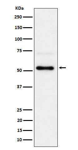 Phospho-Chk1 (S280) (9M10) Rabbit Monoclonal Antibody