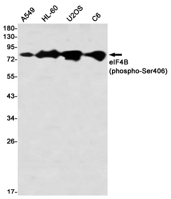 Phospho-eIF4B (Ser406) (13H6) Rabbit Monoclonal Antibody