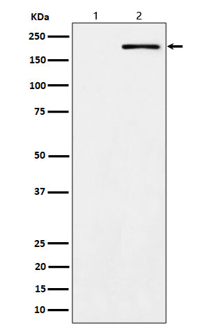 Phospho-ErbB2 (Y1139) (12W6) Rabbit Monoclonal Antibody