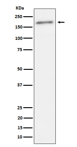Phospho-ErbB2(Y1221 + Y1222)   (11Z13) Rabbit Monoclonal Antibody