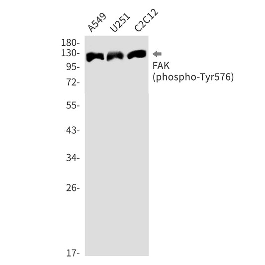 Phospho-FAK (Tyr576) (17X9) Rabbit Monoclonal Antibody