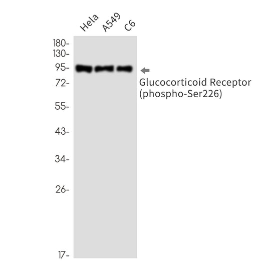 Phospho-Glucocorticoid Receptor (Ser226) (12W11) Rabbit Monoclonal Antibody