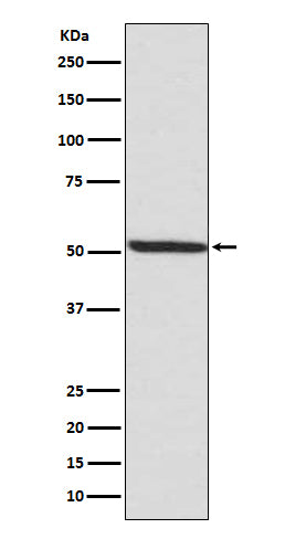 Phospho-IRF3 (Ser386) (9P16) Rabbit Monoclonal Antibody