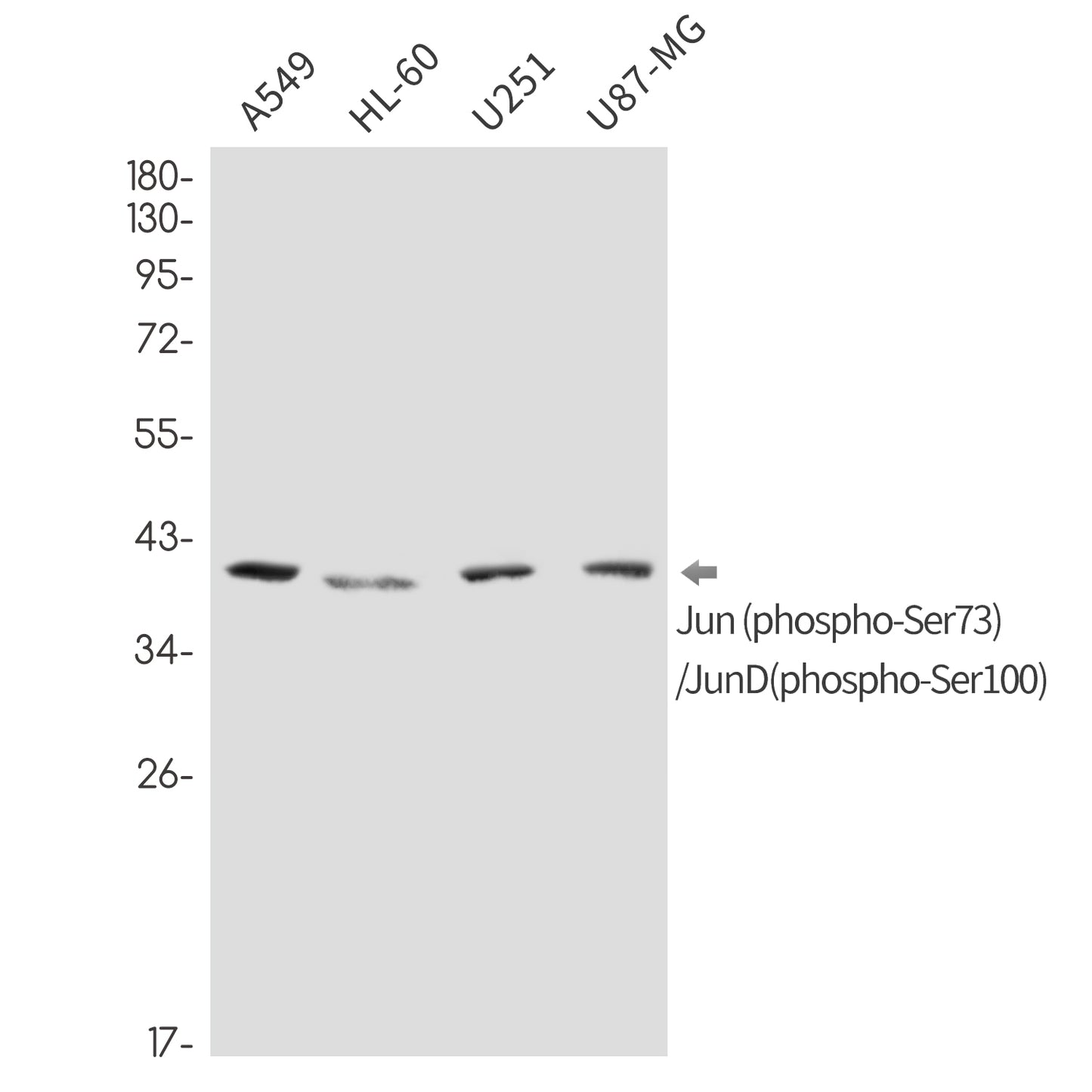 Phospho-Jun/JunD (Ser73/Ser100) (12F13) Rabbit Monoclonal Antibody