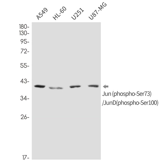 Phospho-Jun/JunD (Ser73/Ser100) (12F13) Rabbit Monoclonal Antibody