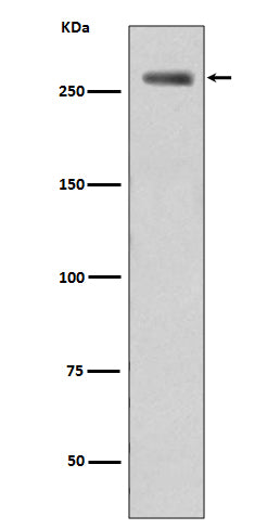 Phospho-LRRK2 (S935)  (16B17) Rabbit Monoclonal Antibody
