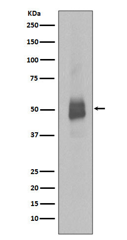 Phospho-Lyn (Y396) (18J18) Rabbit Monoclonal Antibody
