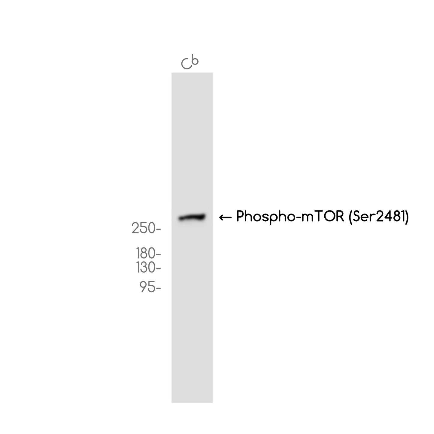 Phospho-mTOR (Ser2481) (10P6) Rabbit Monoclonal Antibody