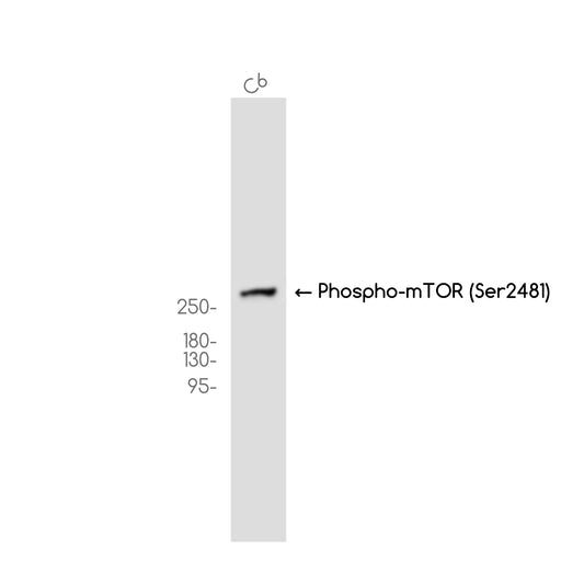 Phospho-mTOR (Ser2481) (10P6) Rabbit Monoclonal Antibody