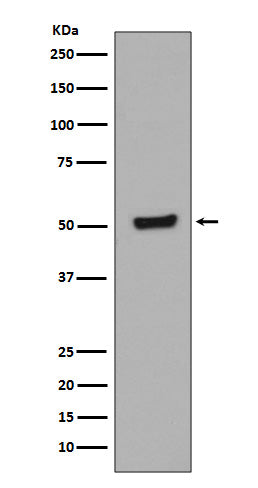Phospho-p53 (T55) (15G3) Rabbit Monoclonal Antibody