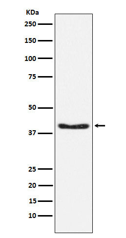 Phospho-PDHA1 (S293) (17H17) Rabbit Monoclonal Antibody
