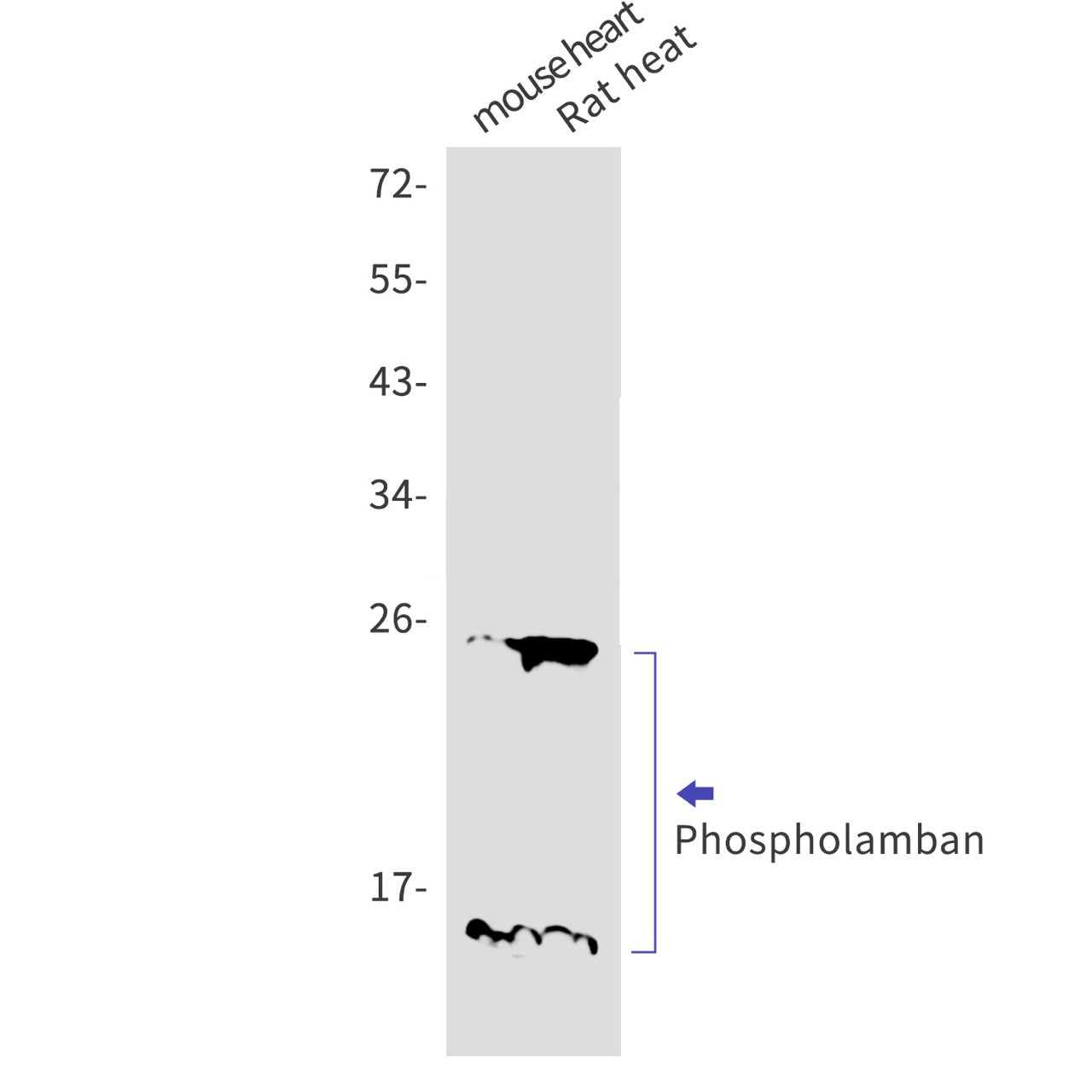 Phospho-Phospholamban (S16) (3B11) Rabbit Monoclonal Antibody