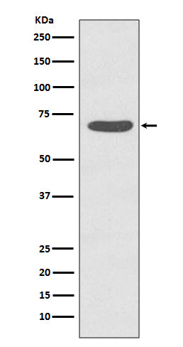 Phospho-PKC zeta (T560) (14P10) Rabbit Monoclonal Antibody
