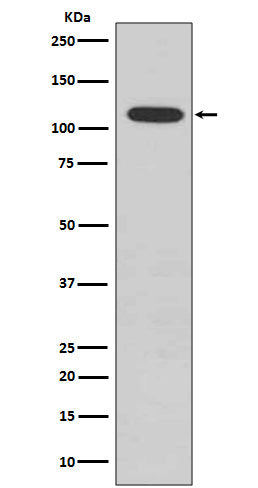 Phospho-Retinoblastoma (S807)  (4H3) Rabbit Monoclonal Antibody