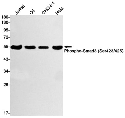 Phospho-Smad3 (Ser423/425) (12O16) Rabbit Monoclonal Antibody