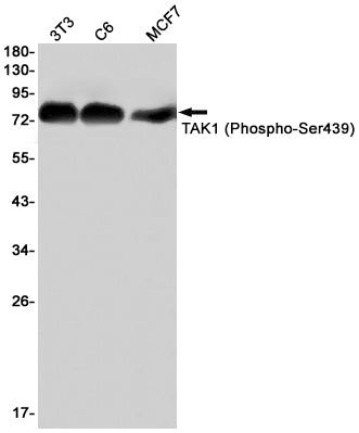 Phospho-TAK1 (S439) (1B14) Rabbit Monoclonal Antibody