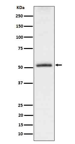 Phospho-Tau (S198) (8V4) Rabbit Monoclonal Antibody