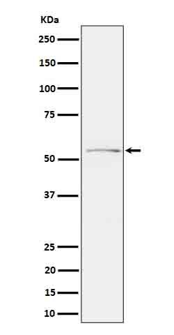 Phospho-Tau (S214) (12D14) Rabbit Monoclonal Antibody