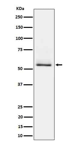 Phospho-Tau (S404) (13R18) Rabbit Monoclonal Antibody
