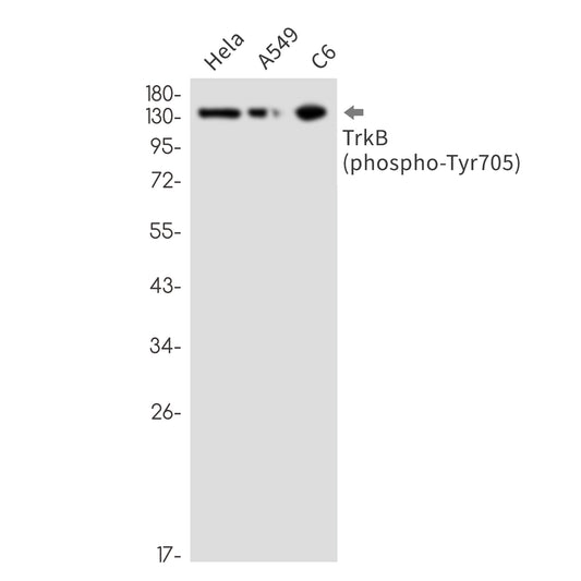 Phospho-TrkB (Tyr705) (3T18) Rabbit Monoclonal Antibody