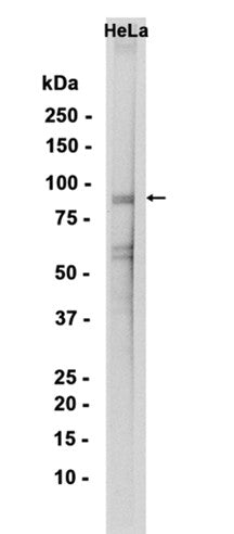 Phospho-UBF1 (S484) (12P4) Rabbit Monoclonal Antibody