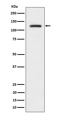 Phospho-ULK1 (S556) (5G1) Rabbit Monoclonal Antibody