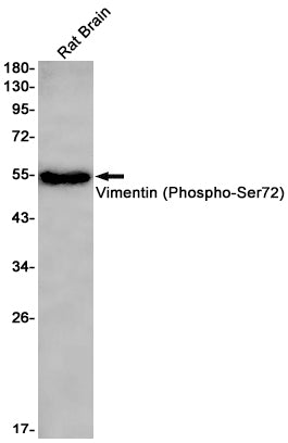 Phospho-Vimentin (S39) (12A17) Rabbit Monoclonal Antibody