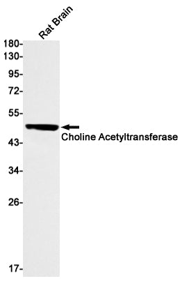Choline Acetyltransferase (18L12) Rabbit Monoclonal Antibody
