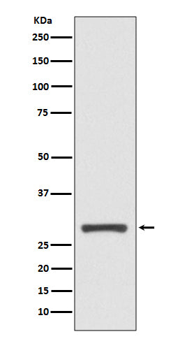 14-3-3 sigma (5P11) Rabbit Monoclonal Antibody