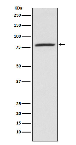 5 Lipoxygenase (15E11) Rabbit Monoclonal Antibody
