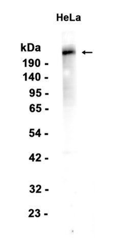 53BP1 (2B15) Rabbit Monoclonal Antibody